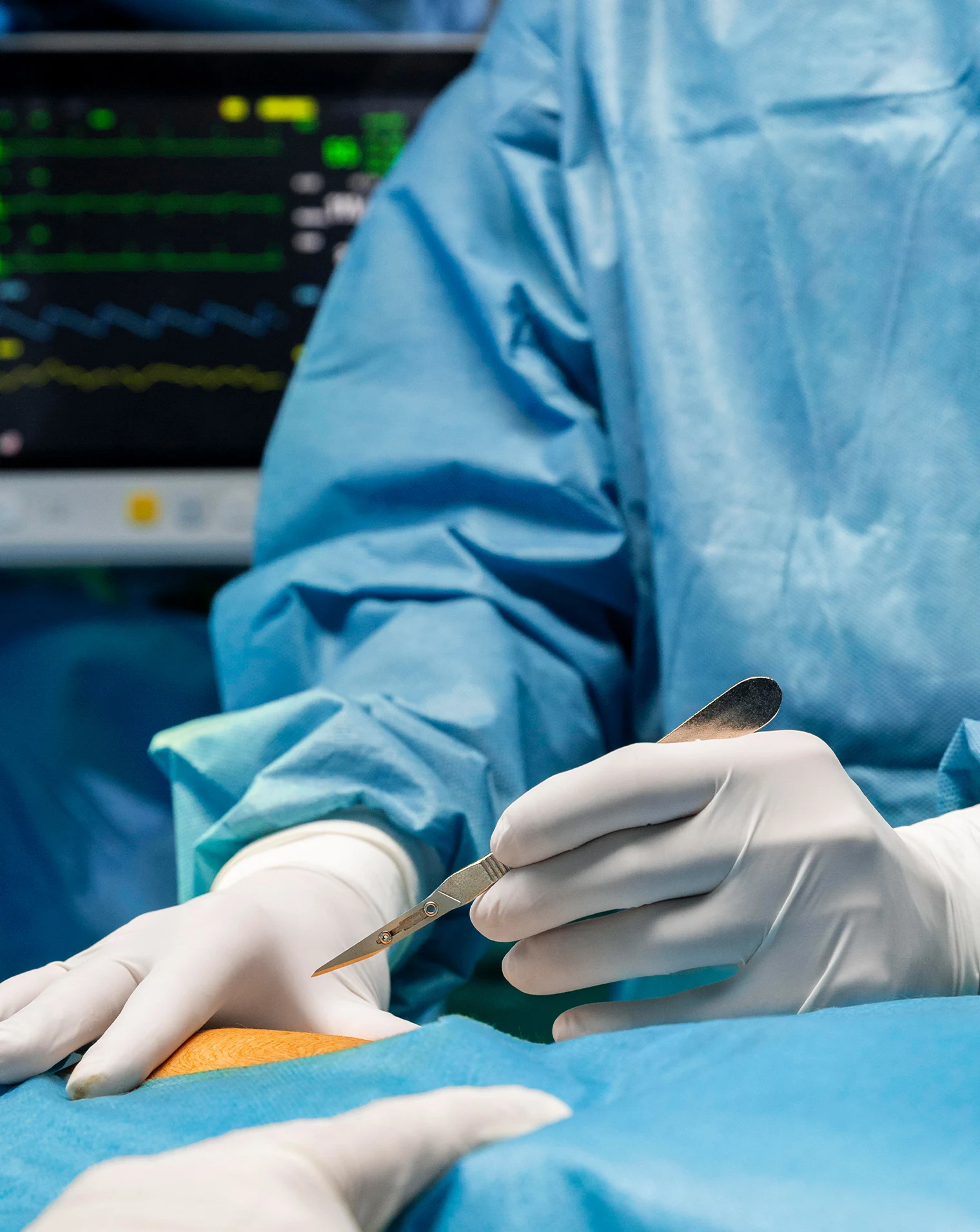 Varicocele Embolization Treatment