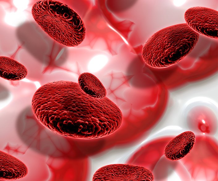 Difference between an Arteriovenous Malformation and a Cavernous Hemangioma?