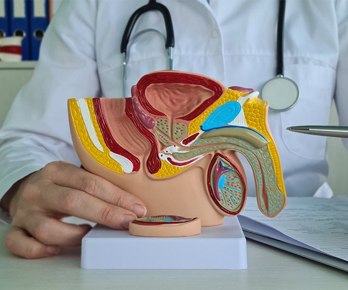 6 Benefits of Treating Varicoceles Without Surgery