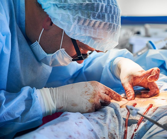 Vascular Surgeon in Delhi