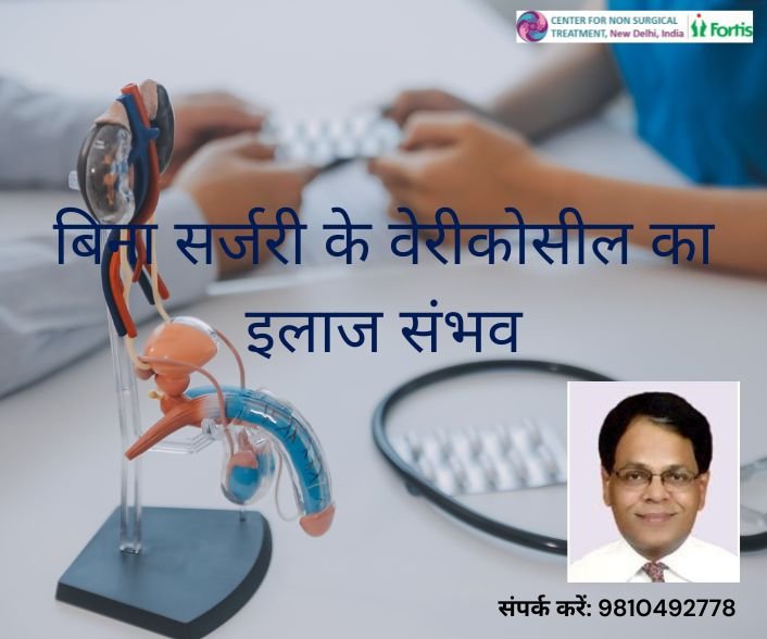 बिना सर्जरी के वेरीकोसील का इलाज संभव