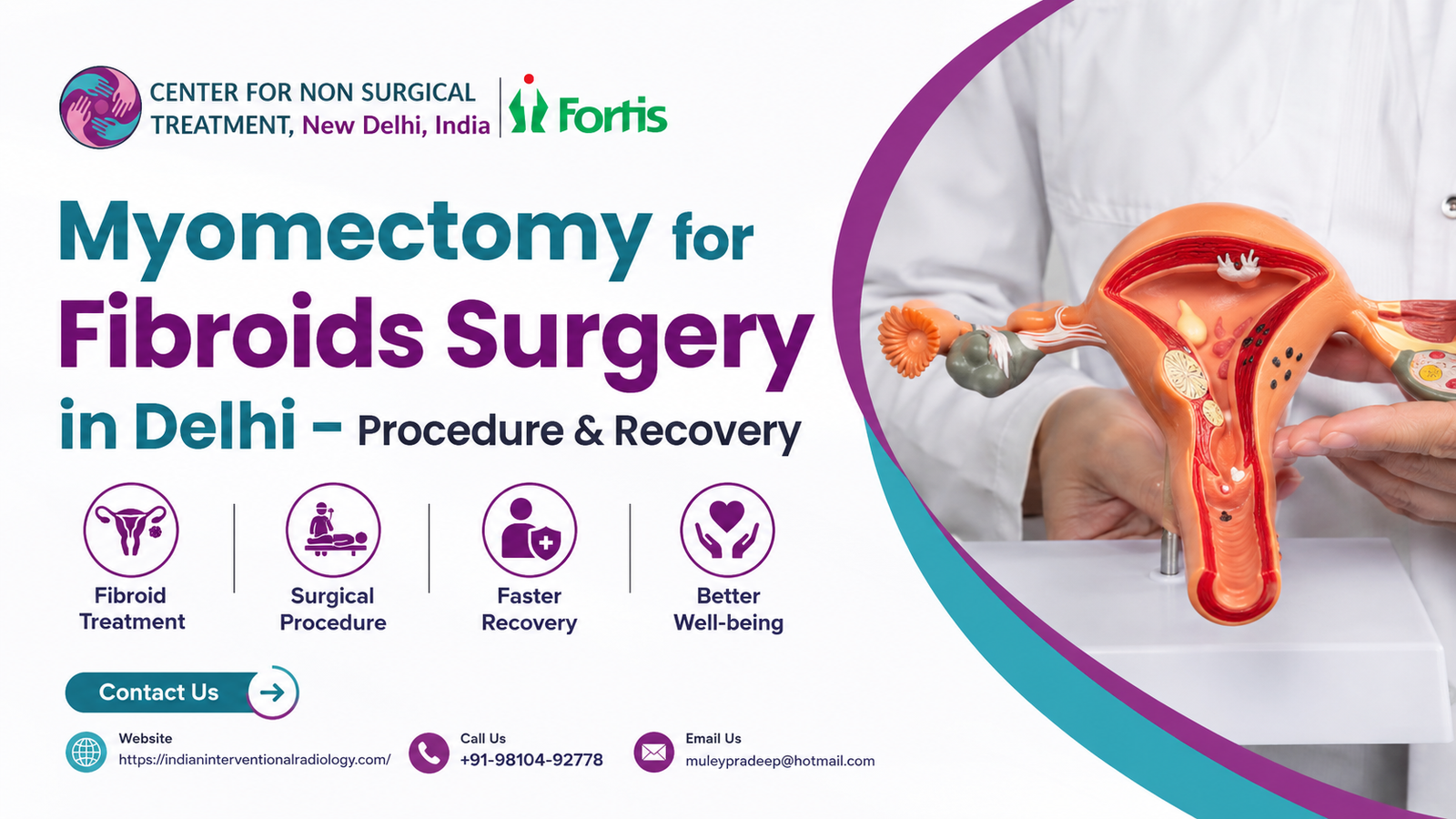 Myomectomy for Fibroids Surgery in Delhi – Procedure & Recovery